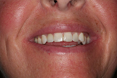 smile case transformation
