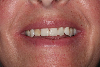 smile case transformation