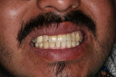 smile case transformation