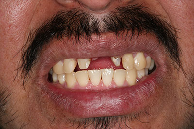 smile case transformation
