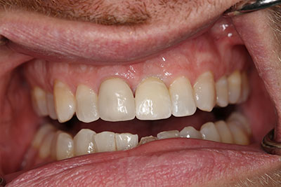 smile case transformation