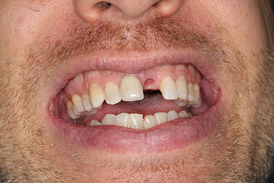 smile case transformation