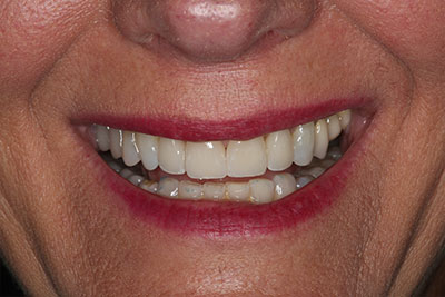 smile case transformation