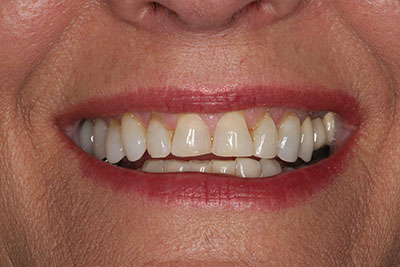 smile case transformation