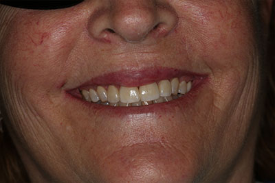 smile case transformation