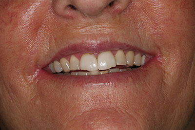 smile case transformation